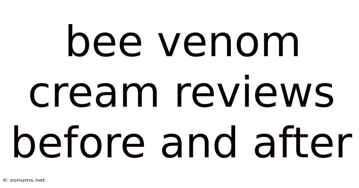 Bee Venom Cream Reviews Before And After