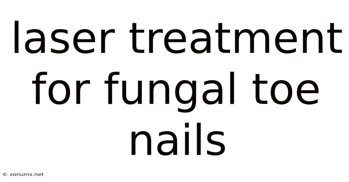 Laser Treatment For Fungal Toe Nails