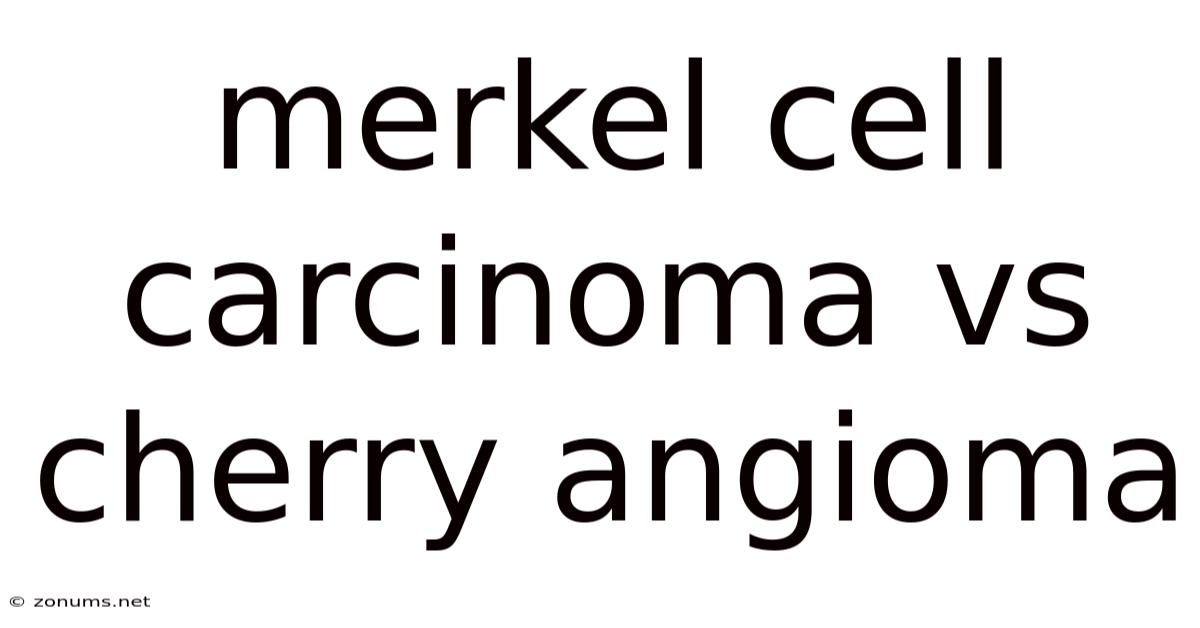 Merkel Cell Carcinoma Vs Cherry Angioma