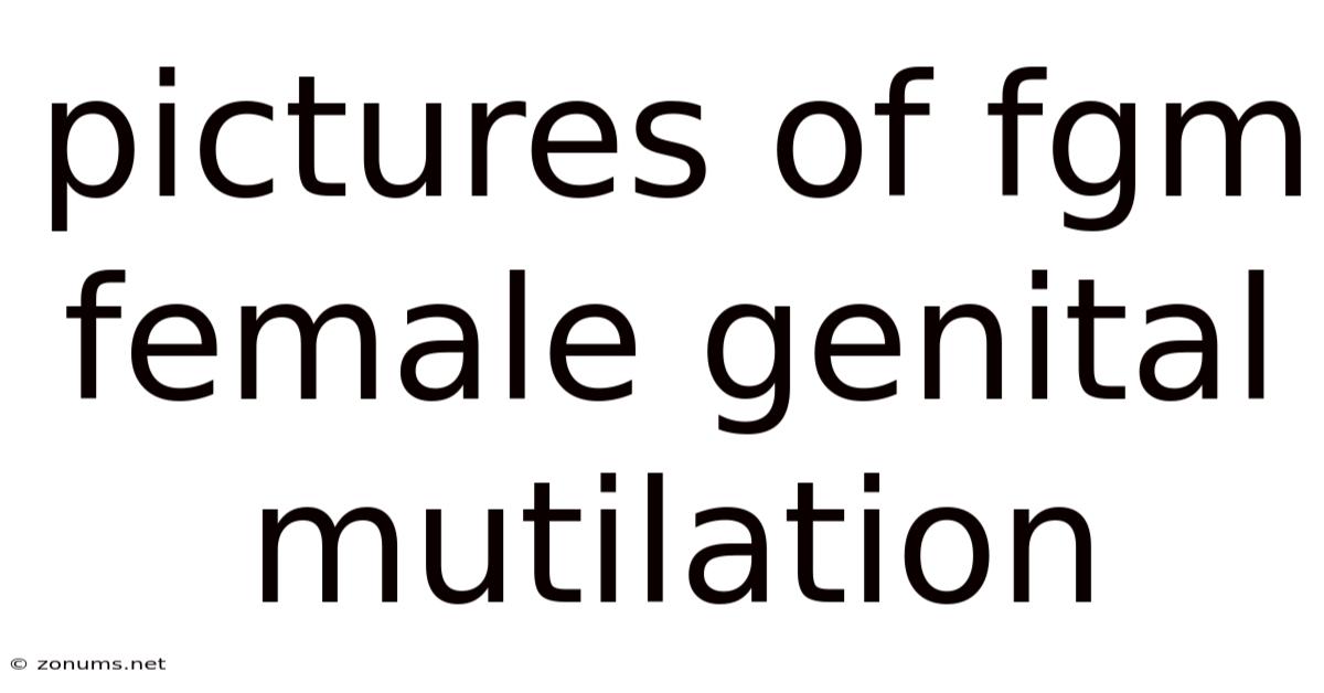 Pictures Of Fgm Female Genital Mutilation