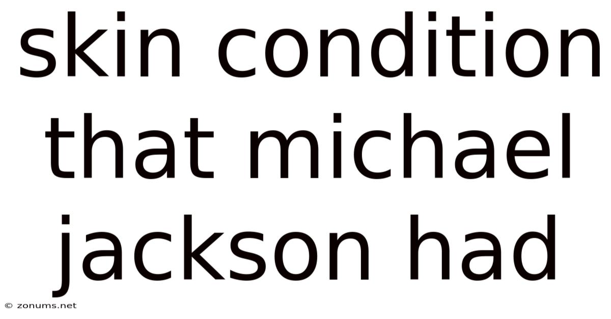 Skin Condition That Michael Jackson Had